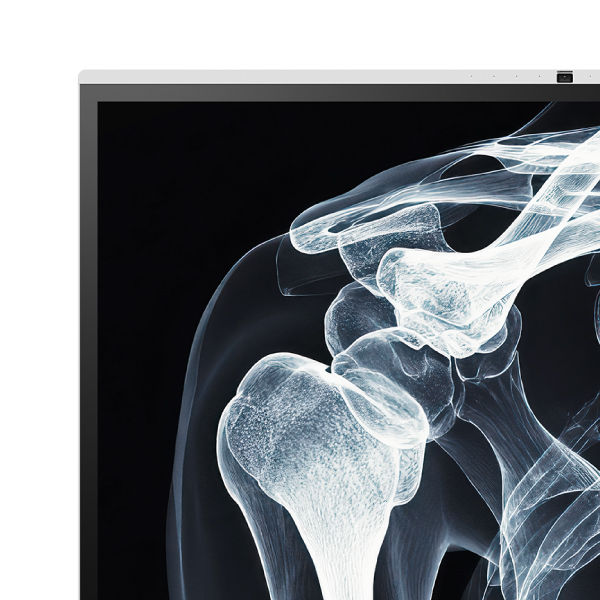 A close-up of a grayscale human shoulder X-ray on a BenQ interactive display in DICOM mode, demonstrating medical-grade accuracy for training and workplace solutions.