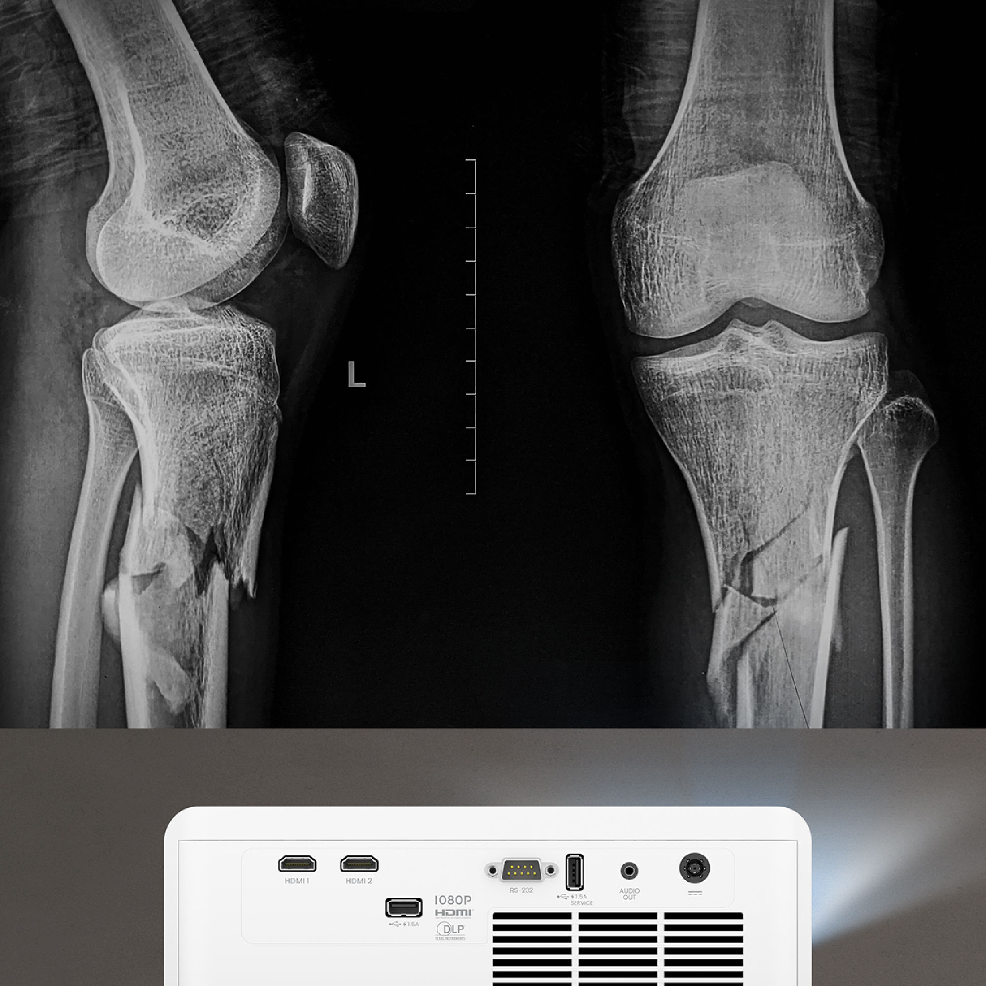 Modo de simulación DICOM