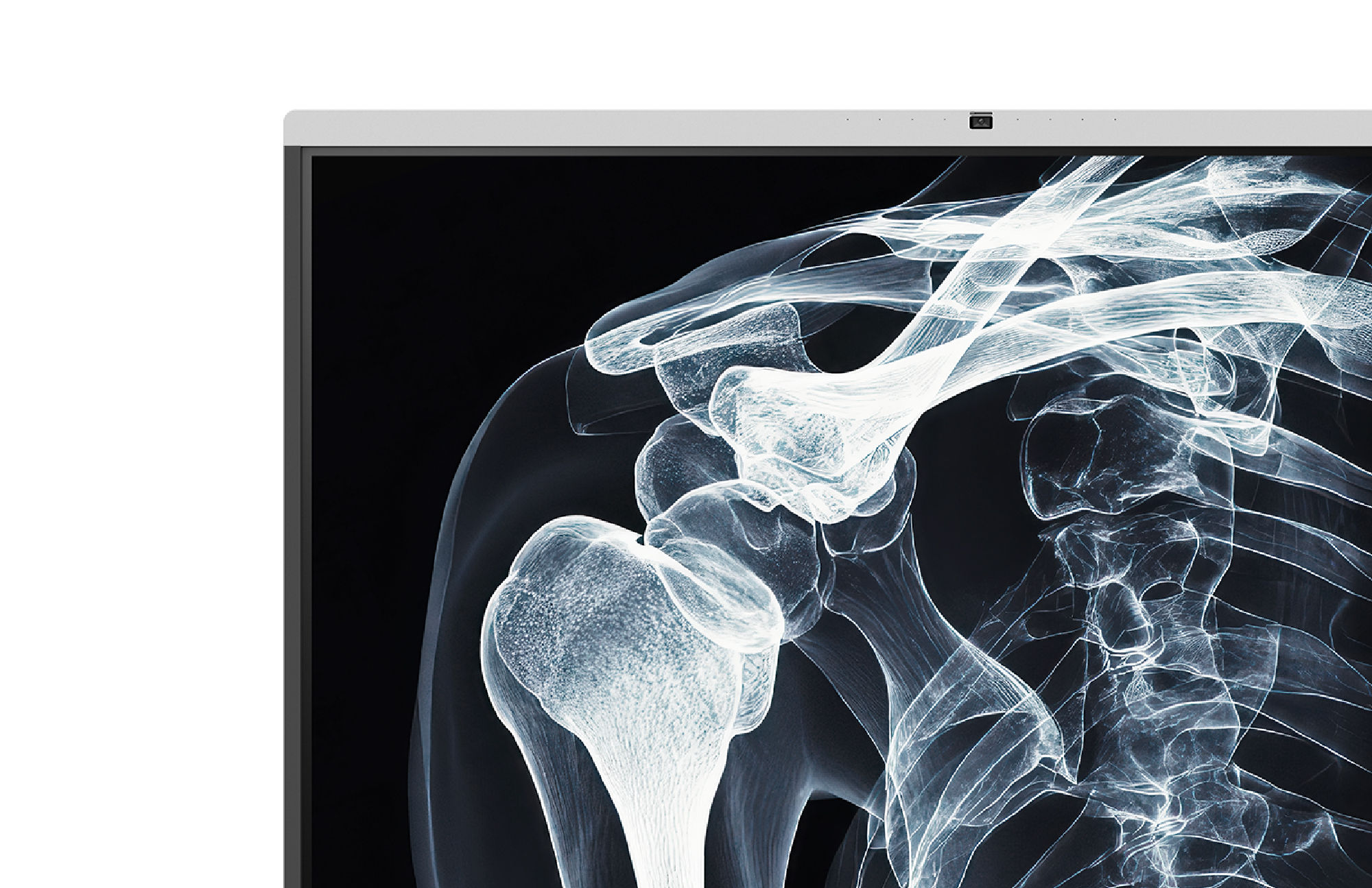 DICOM shoulder X-ray displayed on a BenQ Board