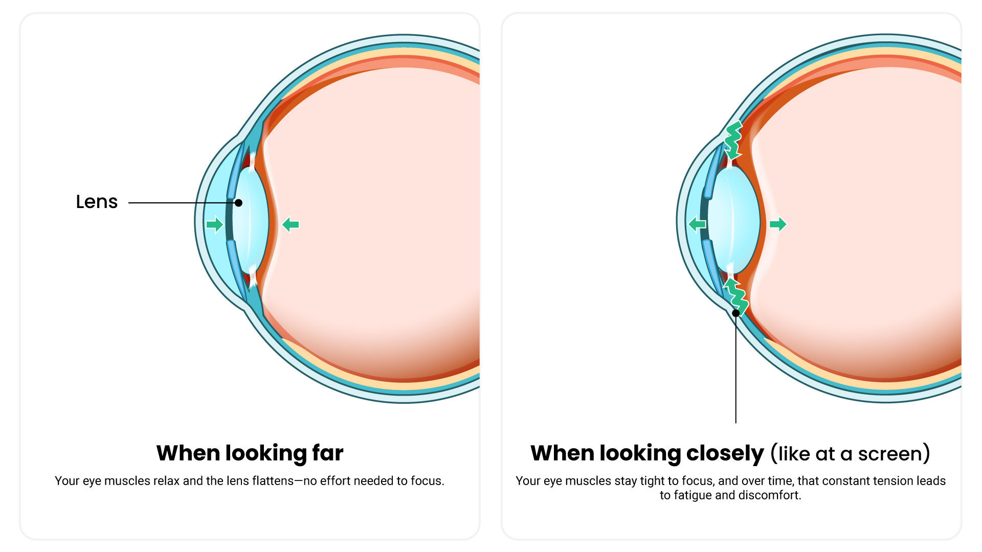Trình tối ưu hình ảnh