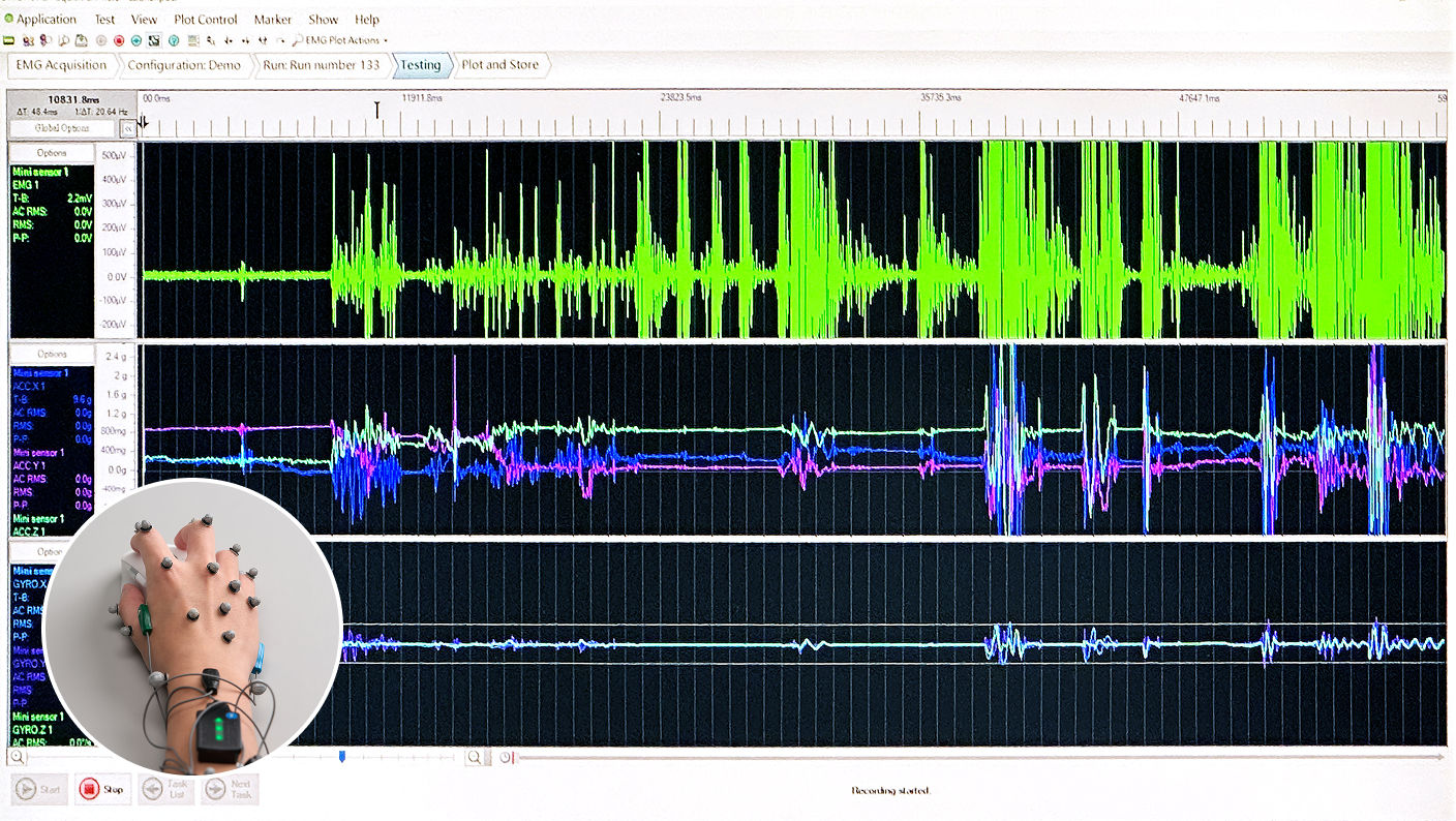 Electromyography (EMG) recording used to measure forearm muscle activity and compare muscle load during ergonomic mouse testing.