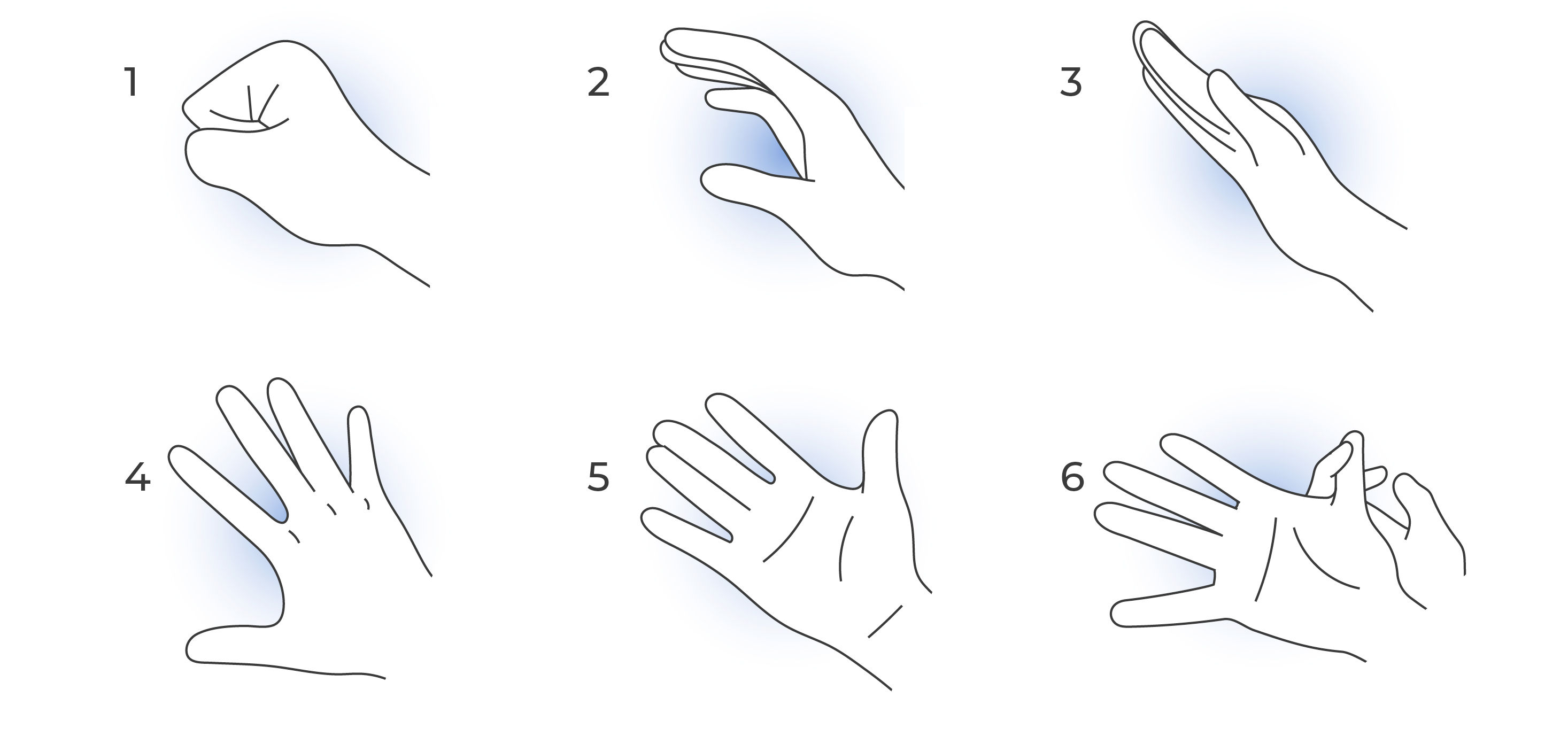 Illustration showing a six-step median nerve glide exercise sequence for the hand and wrist.