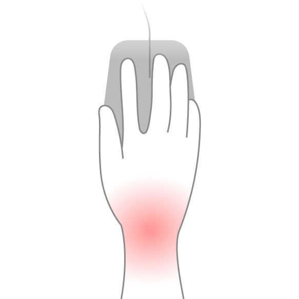 Illustration highlighting the central wrist area affected by excessive wrist extension or flexion during mouse use.