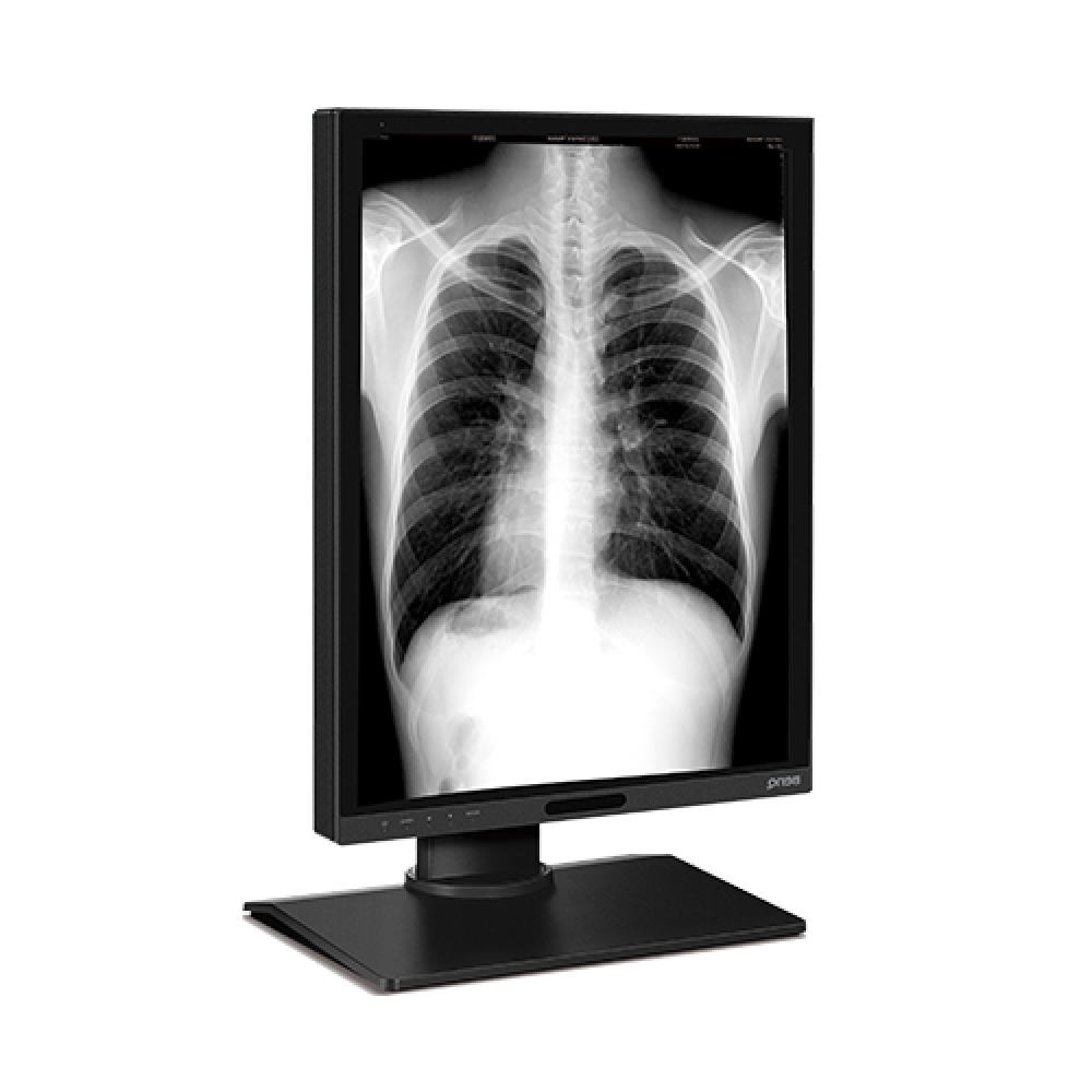 evitar dedo índice locutor diagnostic monitor volverse loco trono Increíble