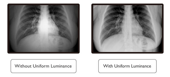 Xray Opaque Contrast Medium That Shows Stock Photo 308039471