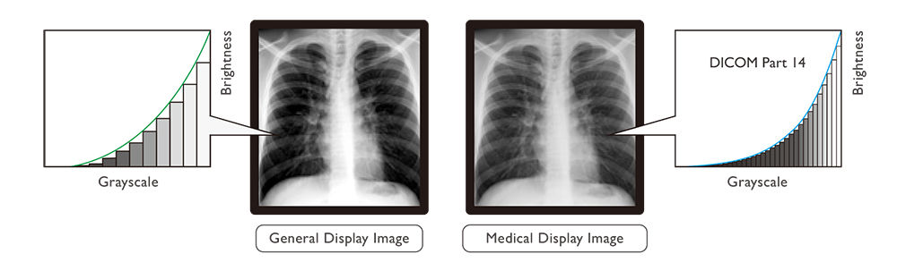 BenQ_Medical Monitor Brochure_p5-p6_20150811_FA